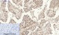 MDM2 Polyclonal Antibody